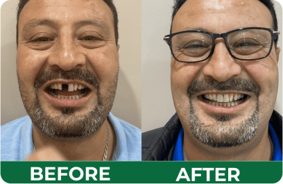 Before and After - Dental Care