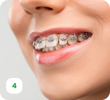 Orthodontics